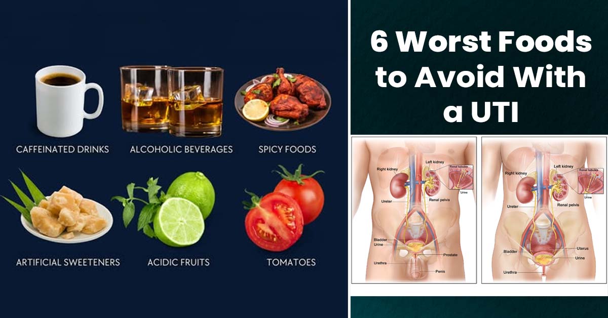 Do You Know the 6 Worst Foods to Avoid with a UTI?